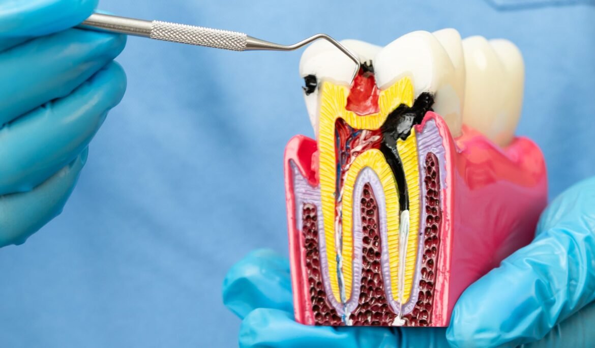 Root canal North Canton